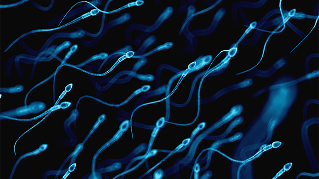 a microscopic image of sperm cells